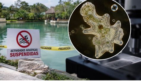 Lagos contaminados con ameba comecerebros