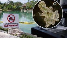 Lagos contaminados con ameba comecerebros