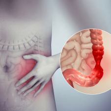 Síndrome de Intestino Irritable: Síntomas y su Impacto Real