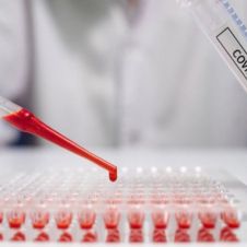 cientifico-analizando-muestras-de-sangre.jpeg