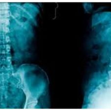 Radiografía de columna vertebral, herramienta eficaz para detección de lesiones.jpg