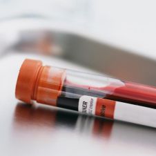 prueba-de-sangre-1.jpg