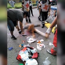 Atención. Un joven quedó lesionado y se estaba desangrando, tras ser arrollado por un auto, cuando viajaba en su moto en Cuautla.