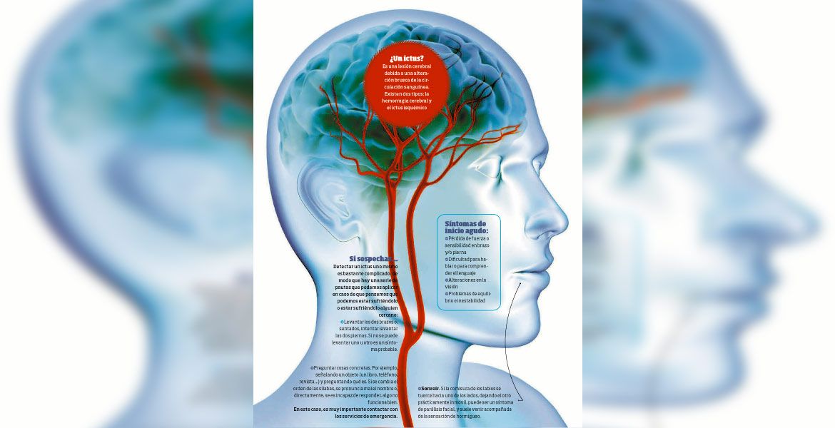Derrame cerebral de cuidado...