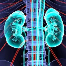 Enfermedad renal, una amenaza para la salud: Entre las cinco principales causas de muerte en México
