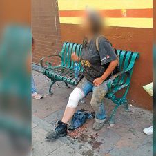 Cae en alcantarilla y se lesiona en Morelos