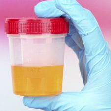thumbnail_urinalysis_1280.jpg