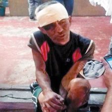 arrollado-por-motocicleta.jpg