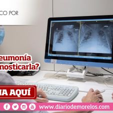 ¿Qué es la neumonía y cómo diagnosticarla?
